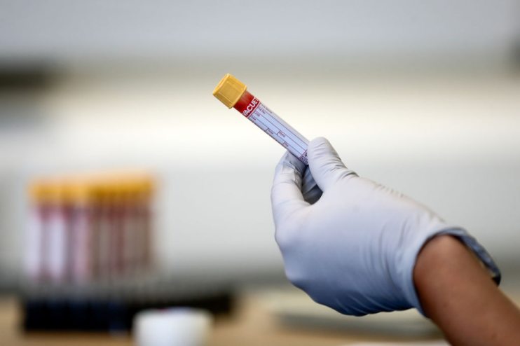 Despite reporting a challenging year, shares in the AIM-listed Fusion Antibodies sprung up 7.5 per cent at market open on Thursday.