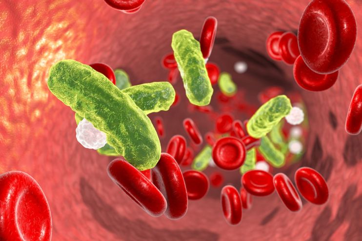Sepsis is a severe and potentially fatal condition caused by infection, usually leading to organ failure.