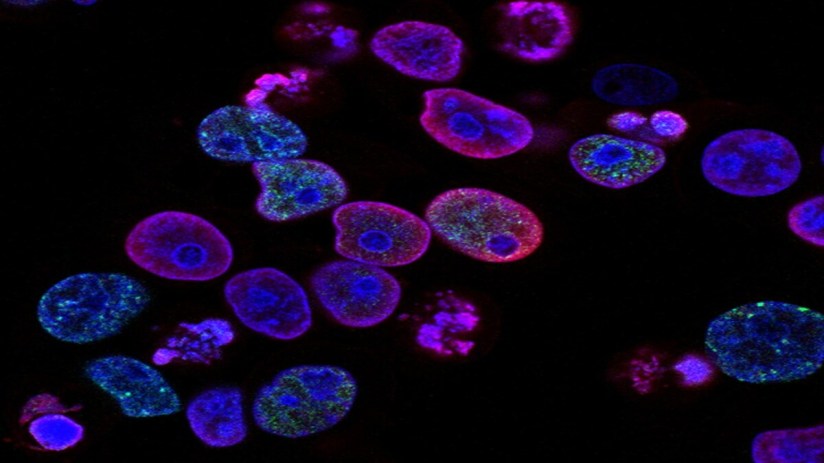 Under the agreement, ANGLE will develop a novel technology for cancer detection using DNA damage response (DDR) tests. 
