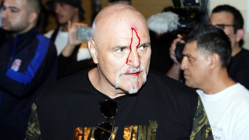 The build up to Tyson Fury’s fight against Ukrainian Oleksandr Usyk got off to an explosive start in Riyadh with the Brit’s father John allegedly headbutting one of the opposition crew.