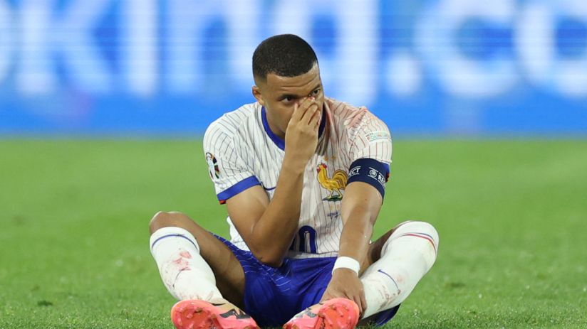 Mbappe suffered a broken nose as France won their Euro 2024 opener on Monday
