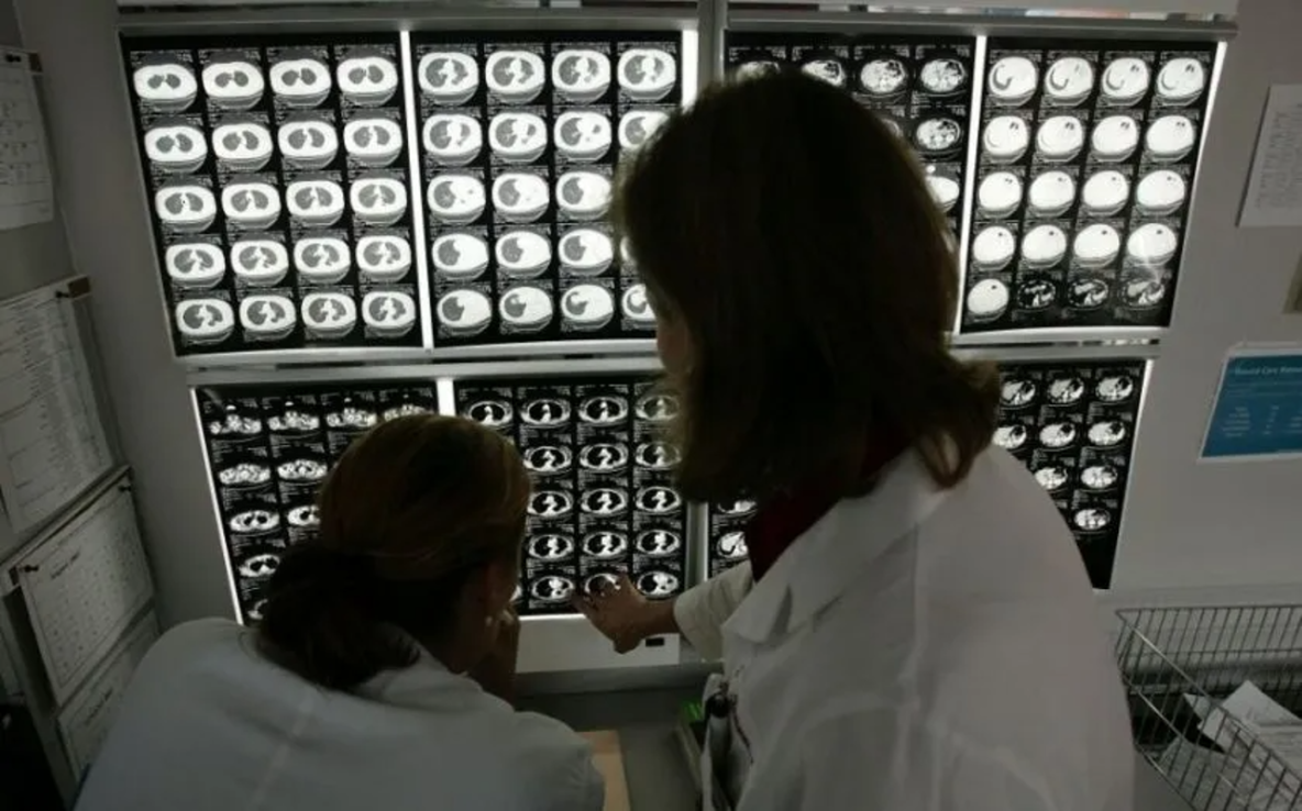 Angle shares fell after it posted a loss of £20.1m for the year ended December 2023, narrowing slightly from a £21.7m loss in 2022.